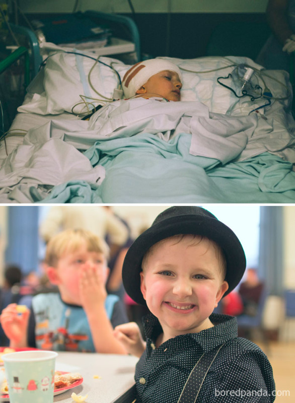 Люди, которые победили рак, в фотографиях «до и после» 