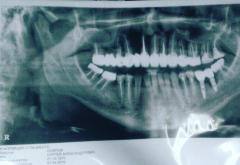 Первый опыт бесплатной стоматологии 