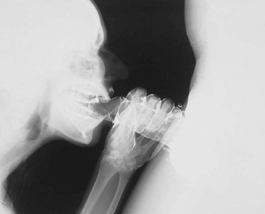 Секс в рентгеновских лучах 