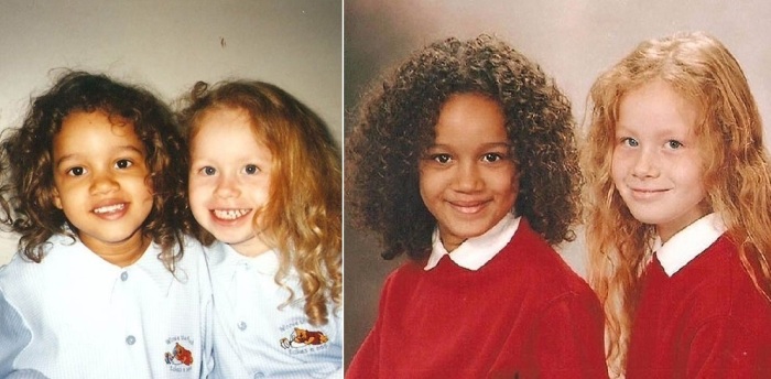  Двойняшки с разным цветом кожи в 1990-х прославились на весь мир: Как они 