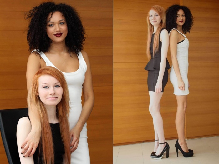  Двойняшки с разным цветом кожи в 1990-х прославились на весь мир: Как они 