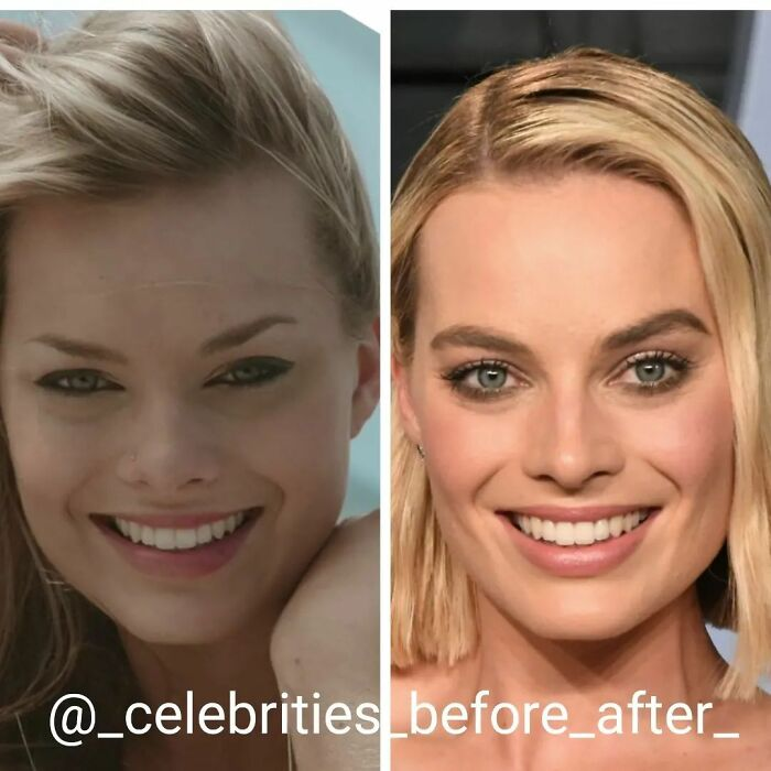 Ð¤Ð¾ÑÐ¾: @_celebrities_before_after_