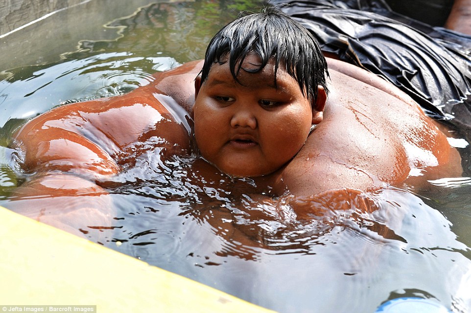 Самый толстый ребенок в мире 