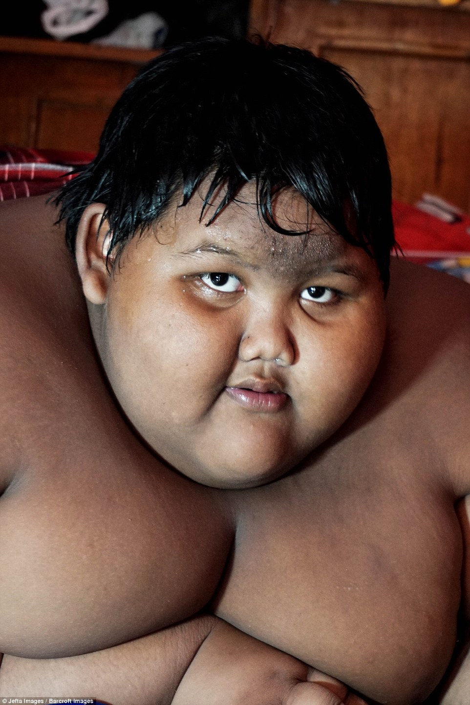 Самый толстый ребенок в мире 